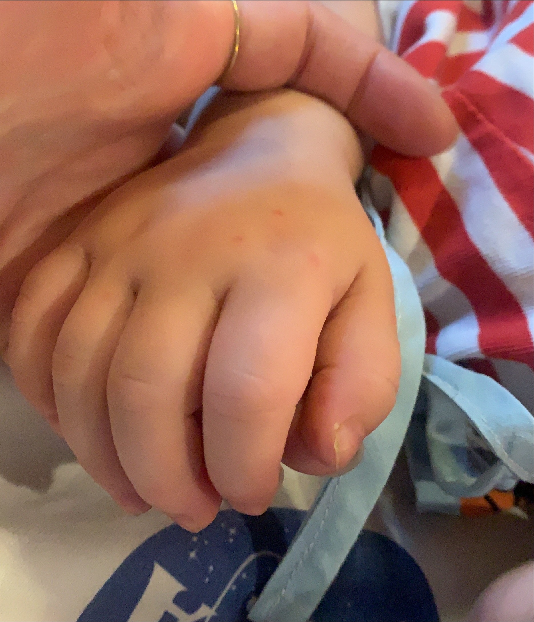 hand-foot-mouth-disease-child-stage2.jpg hand-foot-mouth-disease-child-stage2.jpg